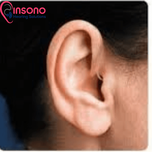 Kit ARRDI 220 view 4