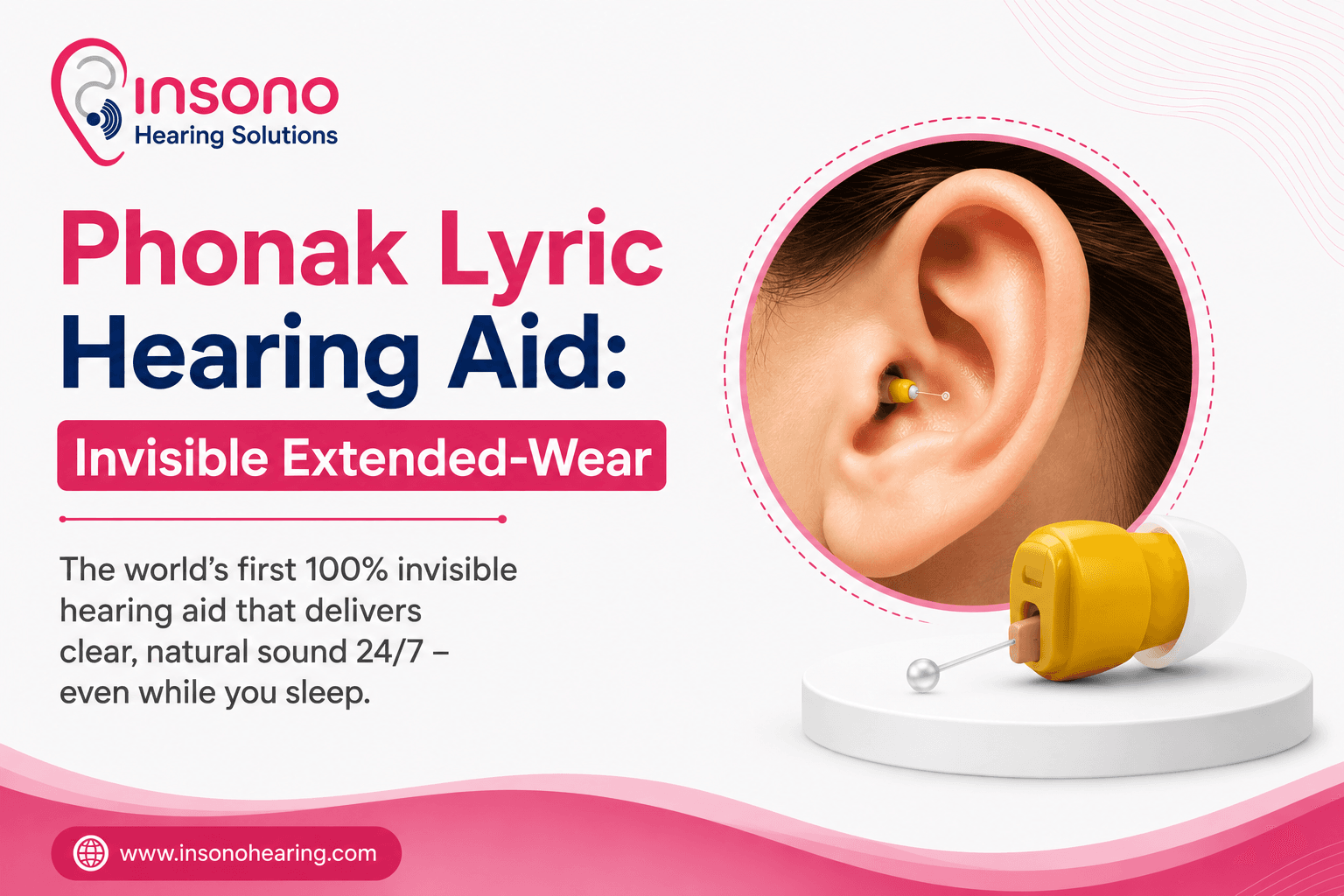 Phonak Lyric Hearing Aid: Invisible Extended-Wear Price & Review (2026)