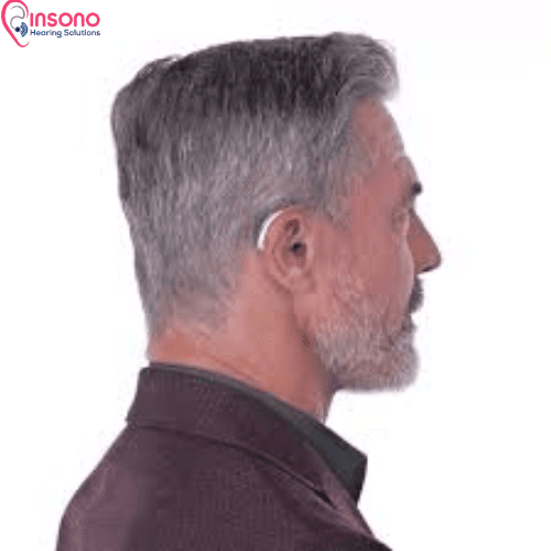 Kit Audeo I 90-R view 2