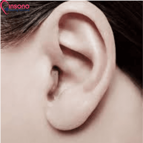 Virto P50-312 NW 0 view 5