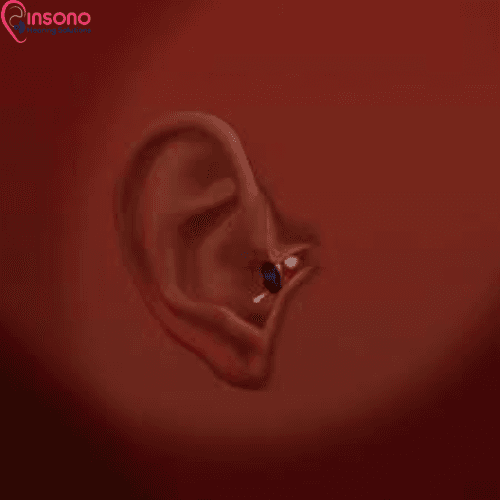 Signia Kit Silk C&G CROS 1IX view 4