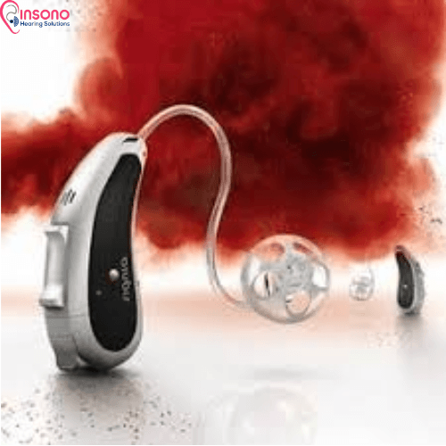 Signia Orion P/SP 75 view 3