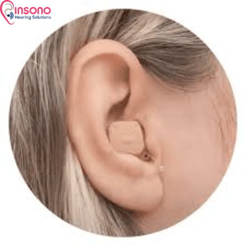 Signia Kit Insio C&G 7AX view 4