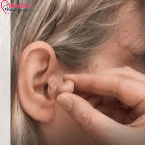 Signia Kit Insio C&G 3AX view 2