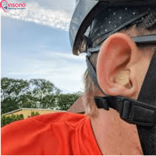 Signia Kit Insio C&G 3AX view 5