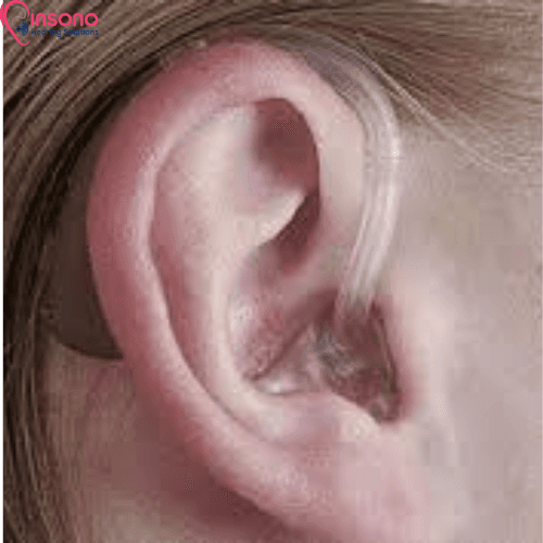 Signia Intuis 4.5 (SP/P/M) view 5