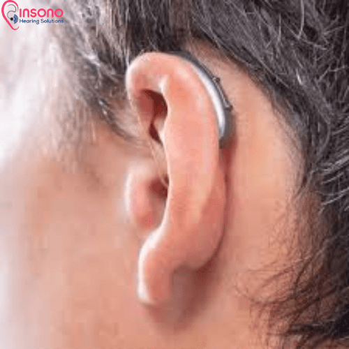 Signia Kit Pure C&G BCT 5IX view 2