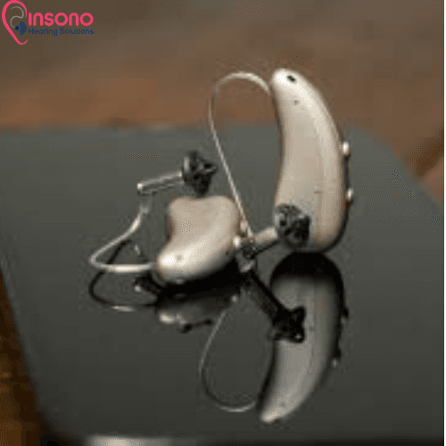 Signia Kit Pure C&G 5IX / T 5IX view 2