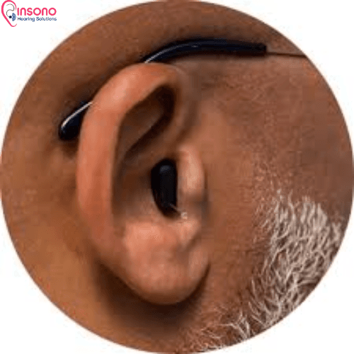 Signia Kit Silk C&G 7IX view 3