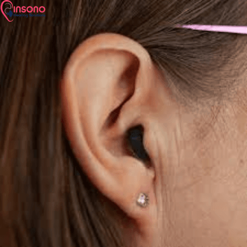 Signia Kit Silk C&G 3IX view 2