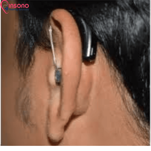 OTICON ALTA MINI RITE POWER (WL) view 2