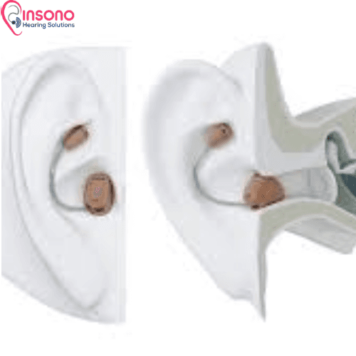 OTICON ALTA POWER CIC (WL)