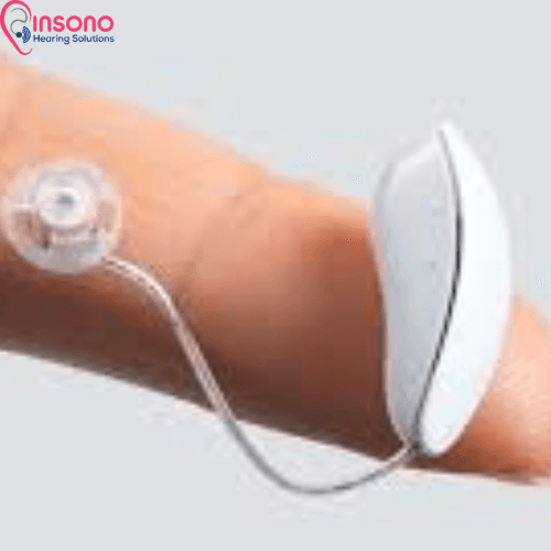 OTICON INTIGA 8 (WL) view 2