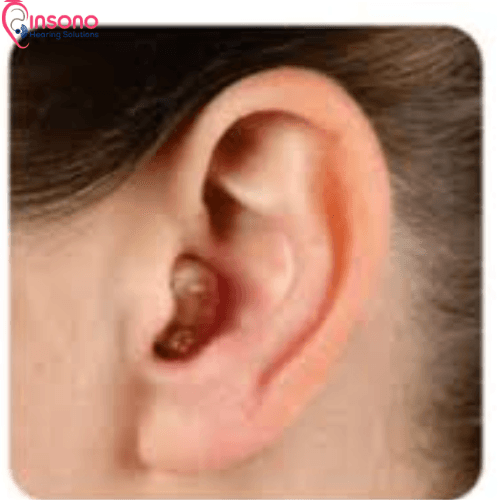 ReSound Nexia 7 ITC (1 Hearing Aid + 1 Custom Charger) view 5