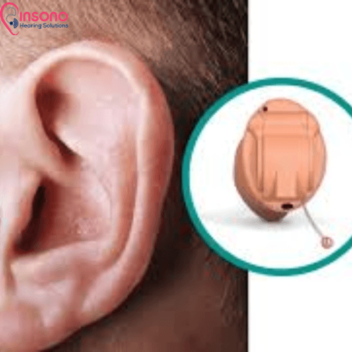 ReSound Nexia 5 IIC view 3