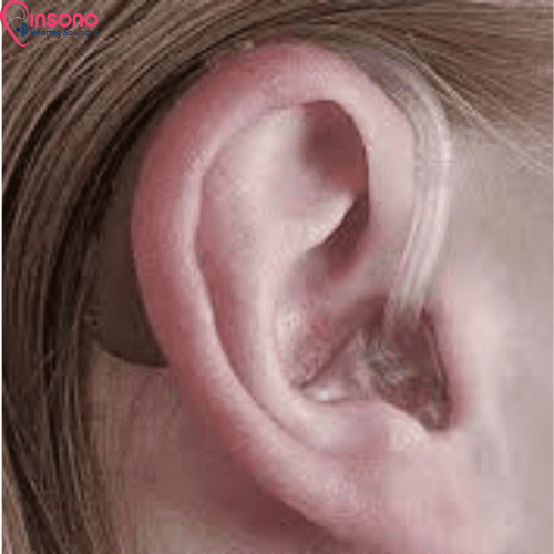 ReSound Nexia 988 BTE (1 Hearing Aid + 1 Desktop Charger) view 4